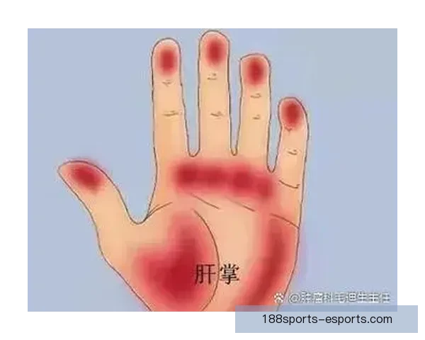 浓眉左手掌恢复良好 本月底将接受复查有望复出